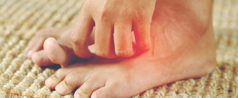 Горят ступни ног: причины, диагностика и как избавиться от дискомфорта